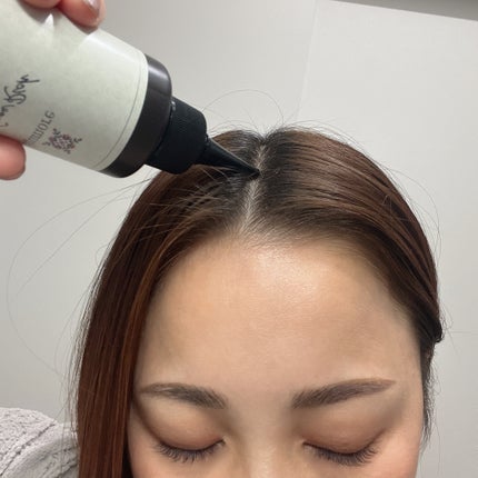 ナノグロウリッチ/iqumore/頭皮ローションを使ったクチコミ(4枚目)