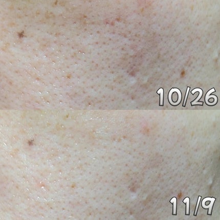 PDRNショット675/COSNORI/美容液を使ったクチコミ(2枚目)