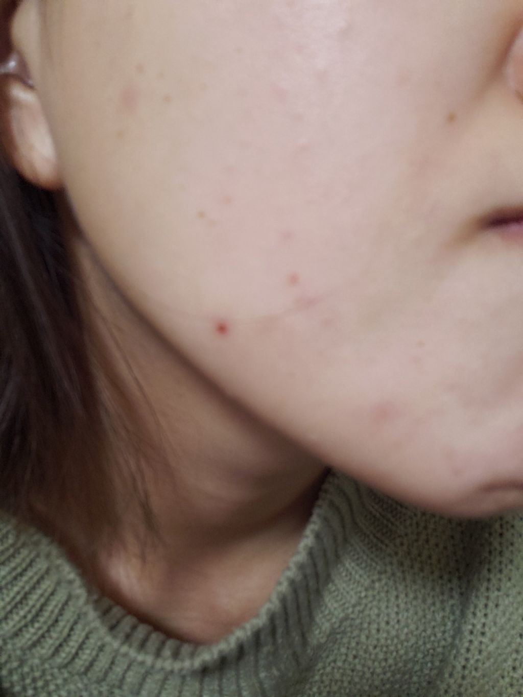 薬用 クリアローション M(しっとりタイプ)/オルビス/化粧水を使ったクチコミ(1枚目)