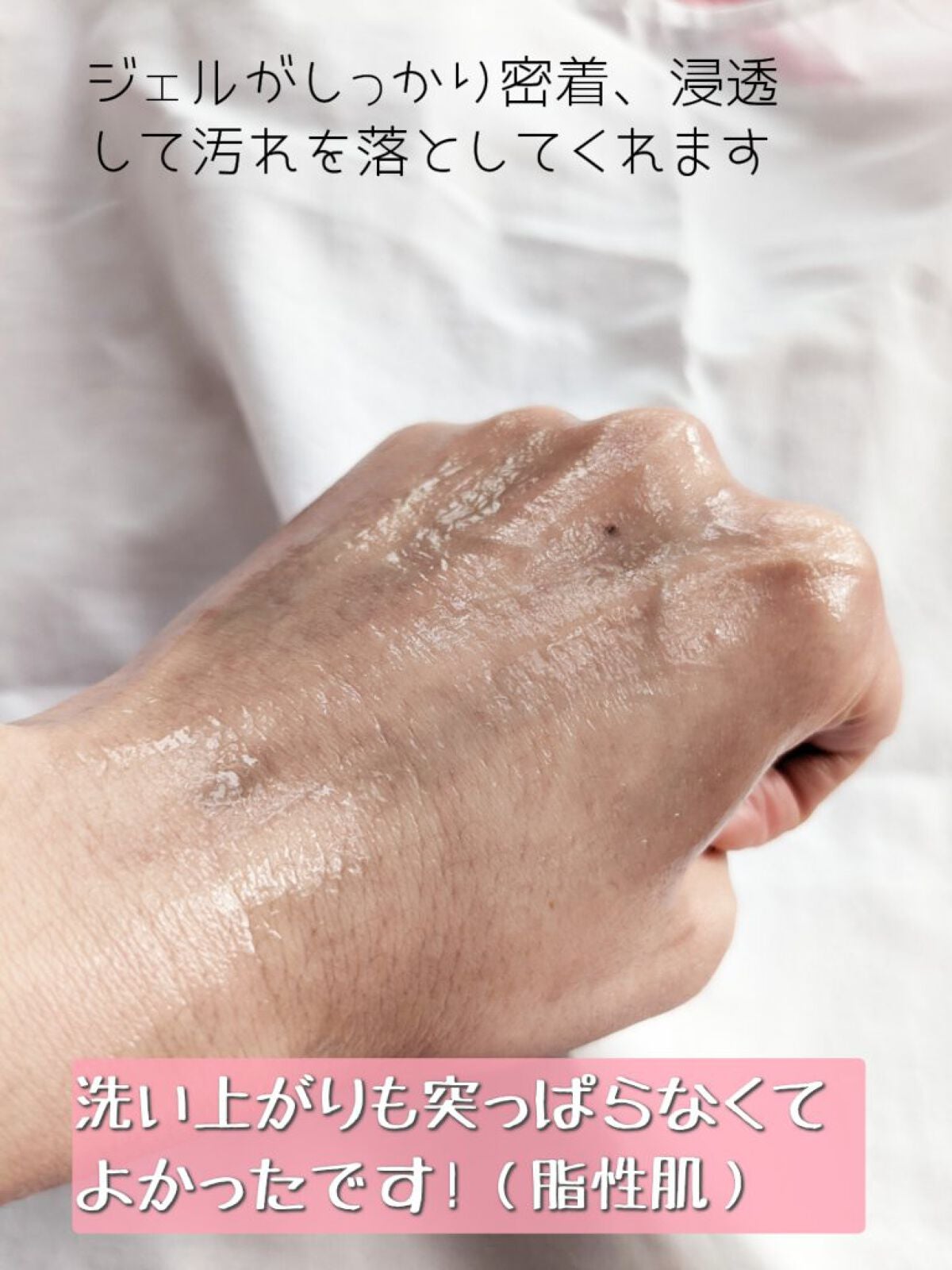 ã㎠åžçæ¯ç©Žã±ã¢ æŽé¡ãžã§ã«/ããŽ/ãã®ä»æŽé¡æã䜿ã£ãã¯ãã³ãïŒ5æç®ïŒ