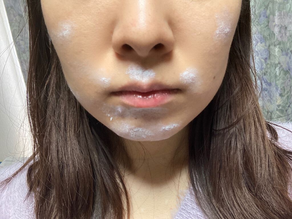 薬用ニキビケア スポッツクリーム/アクネスラボ/フェイスクリームを使ったクチコミ（2枚目）