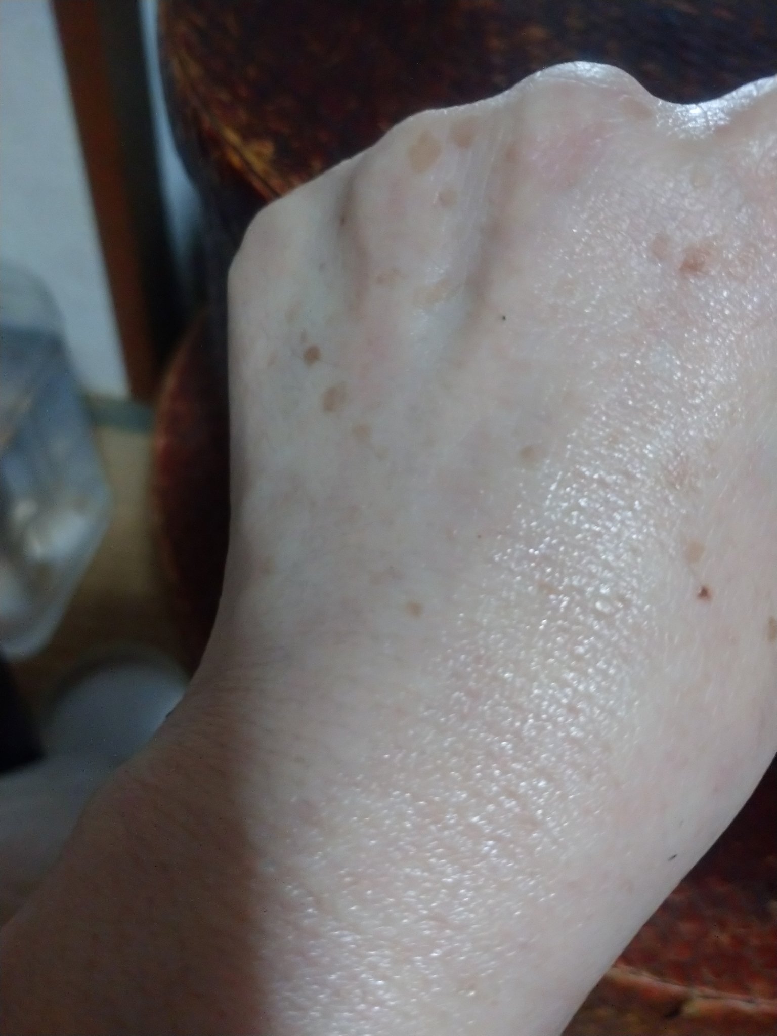 ゼロ1DAYエクソソームショット2000/MEDICUBE/美容液を使ったクチコミ（3枚目）