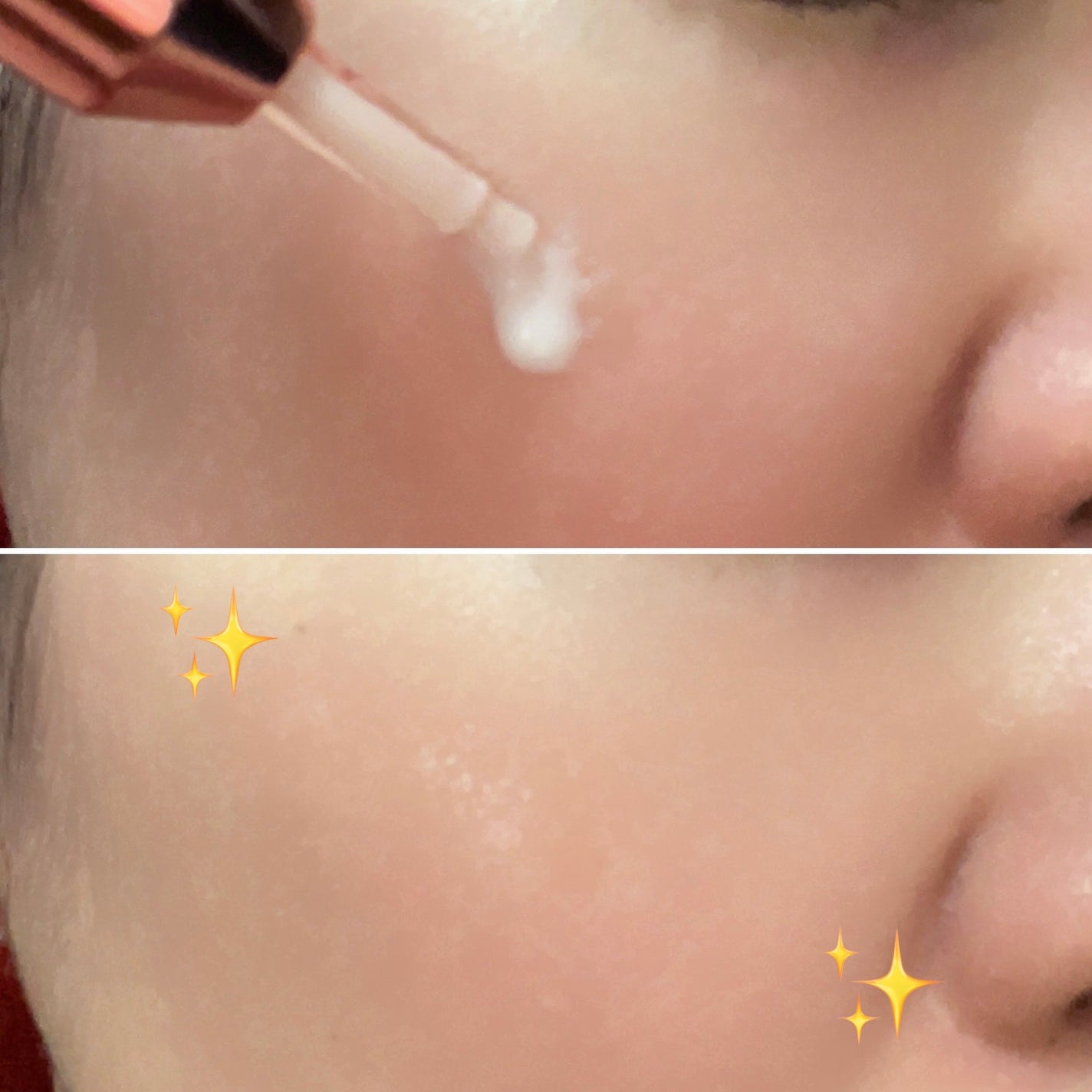 コラーゲングローブースターセラム/MEDICUBE/美容液を使ったクチコミ(4枚目)