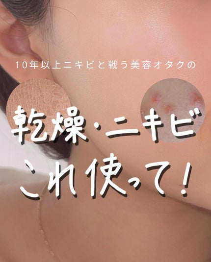 薬用Cクリアホワイトローション/ドクターケイ/化粧水を使ったクチコミ(1枚目)