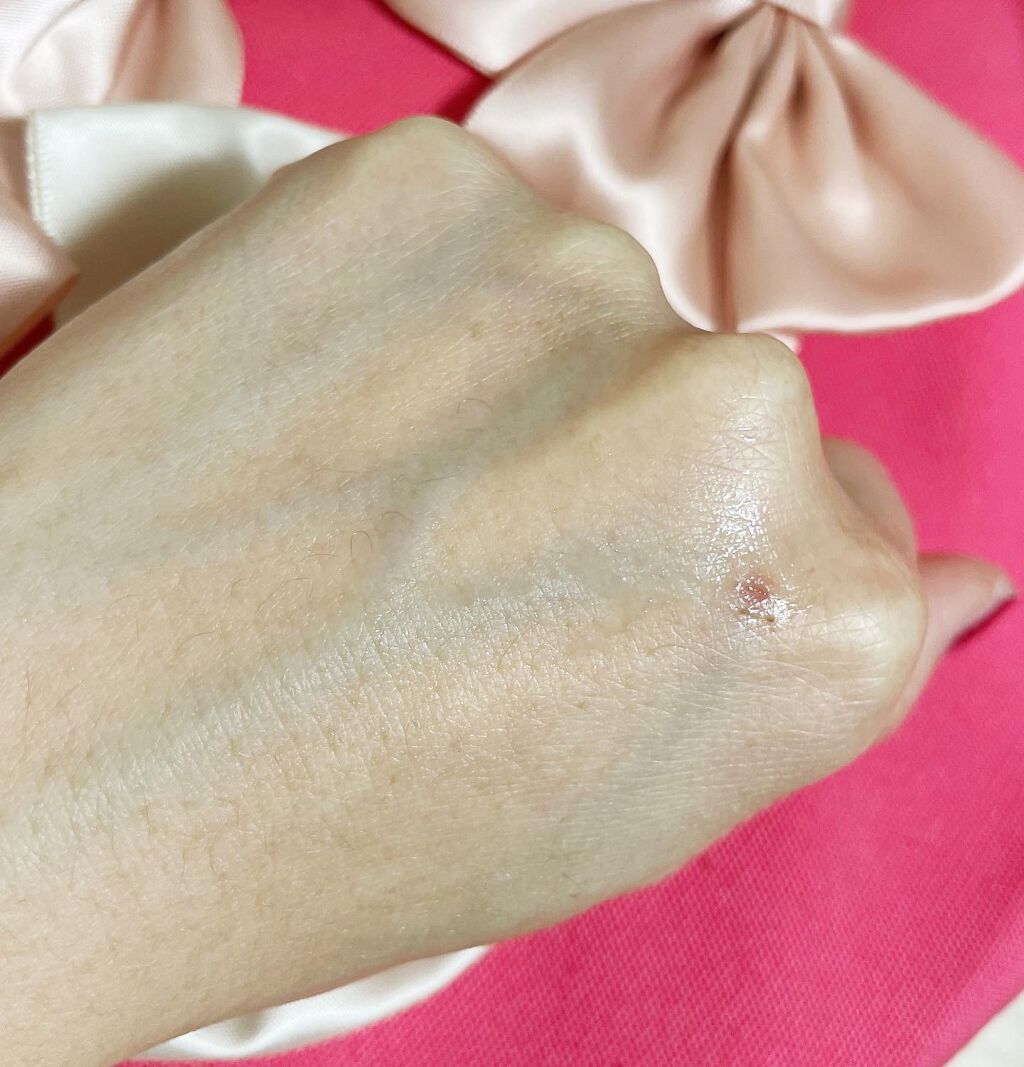 ピンクティーツリートナー/APLIN/化粧水を使ったクチコミ(3枚目)