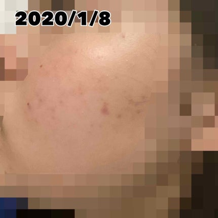 ま on LIPS 「こんにちは!初めての投稿なので温かい目で見て下さると嬉しいです..」(4枚目)