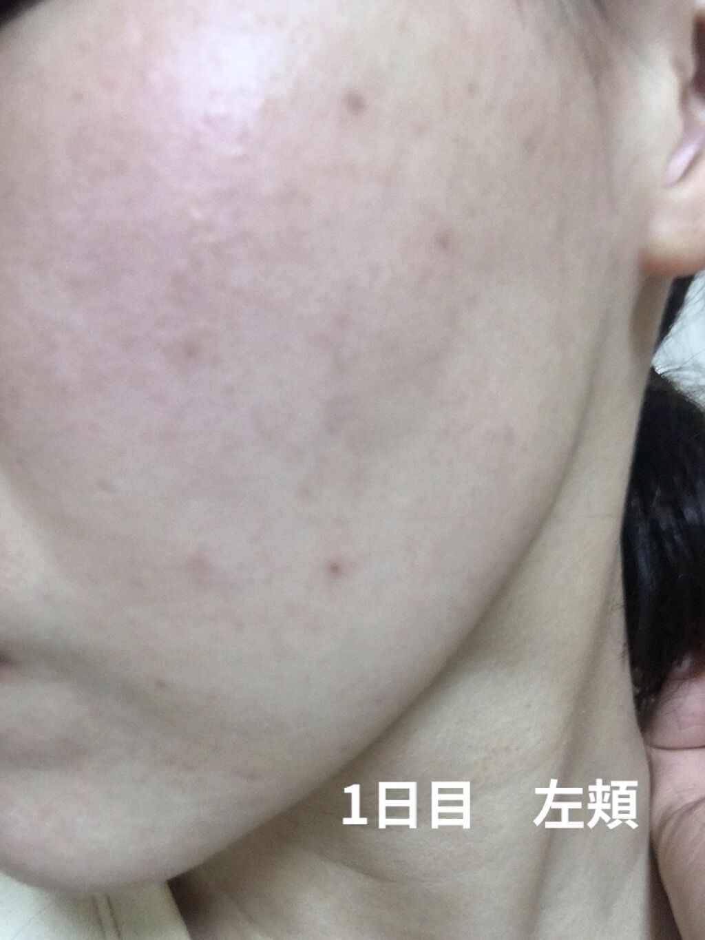 デイリーPD/ZO Skin Health/フェイスクリームを使ったクチコミ（2枚目）