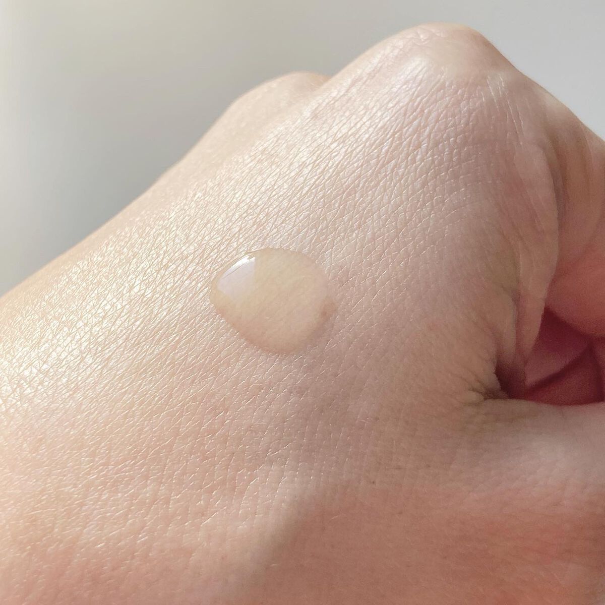 タカミスキンピール/タカミ/ブースター・導入液を使ったクチコミ(3枚目)