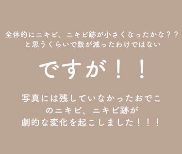 ハトムギ保湿ジェル(ナチュリエ スキンコンディショニングジェル)/ナチュリエ/美容液を使ったクチコミ（3枚目）