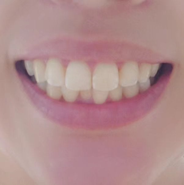 薬用ホワイトニング デンタブラッシュ EX/シーヴァ/その他オーラルケアを使ったクチコミ(4枚目)