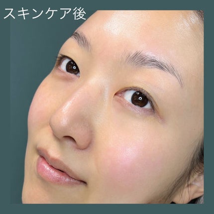 ブラックジェルクレンジング/.akaran/クレンジングジェルを使ったクチコミ(5枚目)