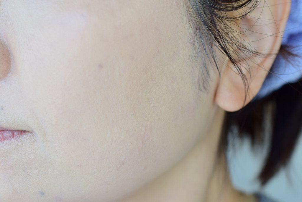 ピンクティーツリーカバークッション/APLIN/クッションファンデーションを使ったクチコミ(5枚目)