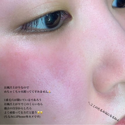 リポスフェリック ビタミンC(リポソーム ビタミンC)/Lypo-Spheric/美容サプリメントを使ったクチコミ(4枚目)