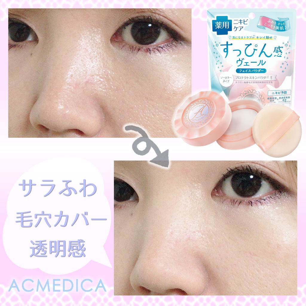 アクメディカ 薬用 フェイスパウダー クリア/ナリスアップ/パウダーファンデーションを使ったクチコミ（2枚目）