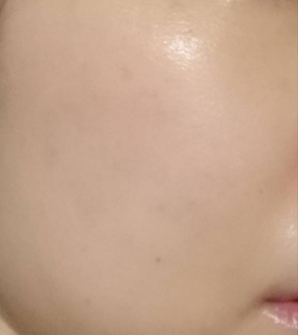 シミ対策美容液/アクアレーベル/美容液を使ったクチコミ(2枚目)