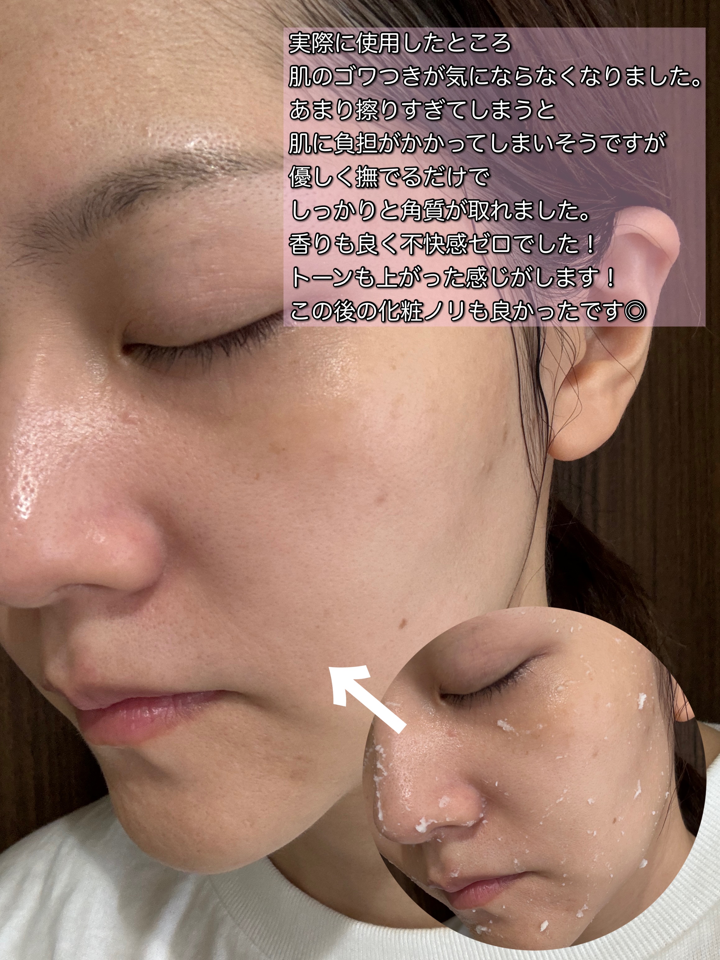 オールティメット パンテノール2%ピーリングジェル/THE FACE SHOP/ピーリングを使ったクチコミ（3枚目）