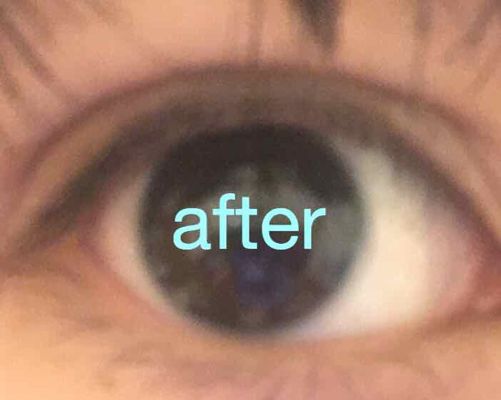 のびーるアイテープ（絆創膏タイプ、レギュラー）/DAISO/二重まぶた用アイテムを使ったクチコミ（3枚目）