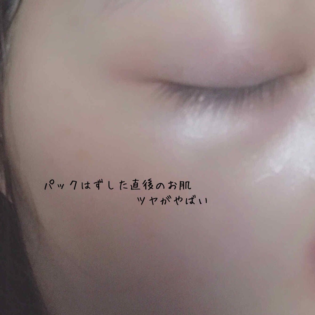 オルフェス バイタルマスク/ALFACE+/シートマスク・パックを使ったクチコミ(2枚目)