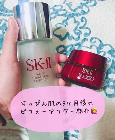 SK-IIは結婚式前にのみ使用しました✨
3ヶ月でトリートメントエッセンスがちょうど半分くらいになりました🙌🏻

2枚目以降お肌の変化です💆🏻‍♀️
左→右へビフォーアフター💕
わかりやすいように全て加