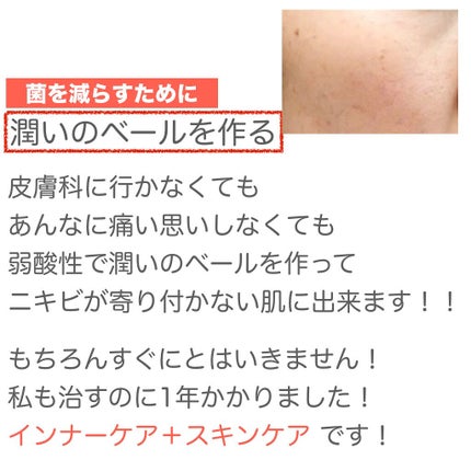 みん on LIPS 「肌荒れしてる方ならば1度は行ったことがあるであろう皮膚科につい..」(8枚目)