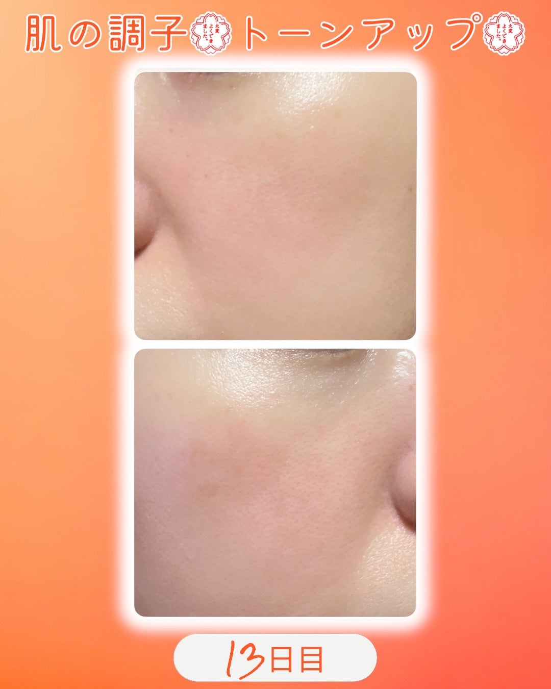 TXトーニングデイリーマスク/VT/その他スキンケアを使ったクチコミ(2枚目)