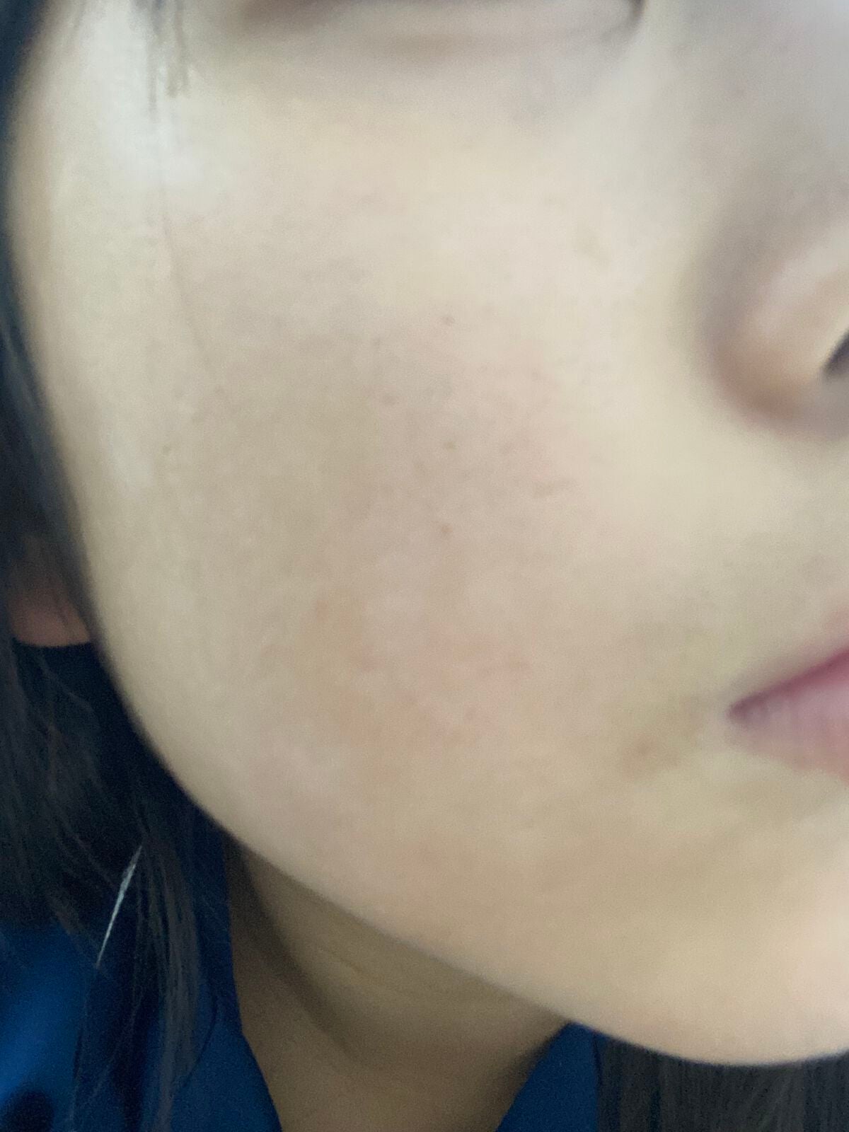 らな on LIPS 「今のやばめの肌を韓国アイドルみたいな毛穴がないトゥルントゥルン..」(1枚目)