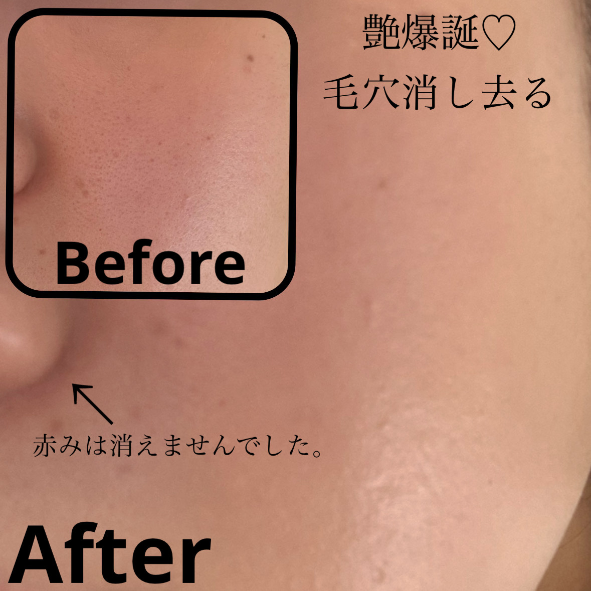 エッセンス スキングロウ ファンデーション/SHISEIDO/リキッドファンデーションを使ったクチコミ（3枚目）