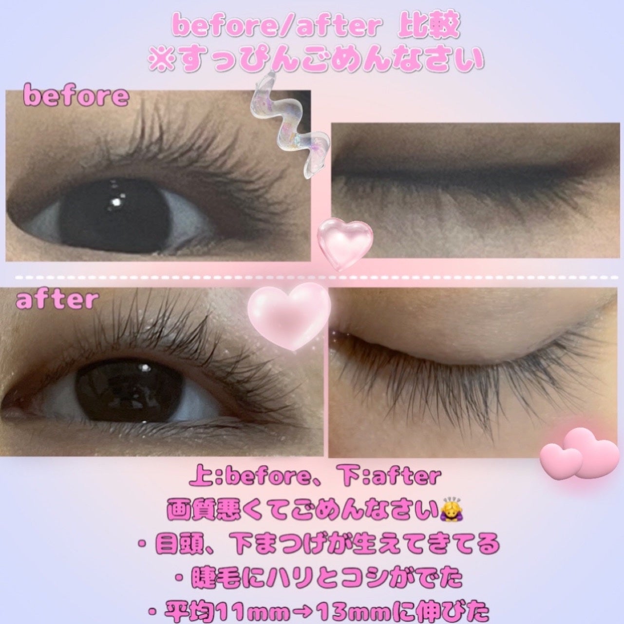 ððŠððððžïžïžïžïž on LIPS ãéåœãŸã€ãçŸå®¹æ¶²äœ¿ãåãã¬ãðããã©ã¢ãããðªœ/DASHUPR..ãïŒ2æç®ïŒ