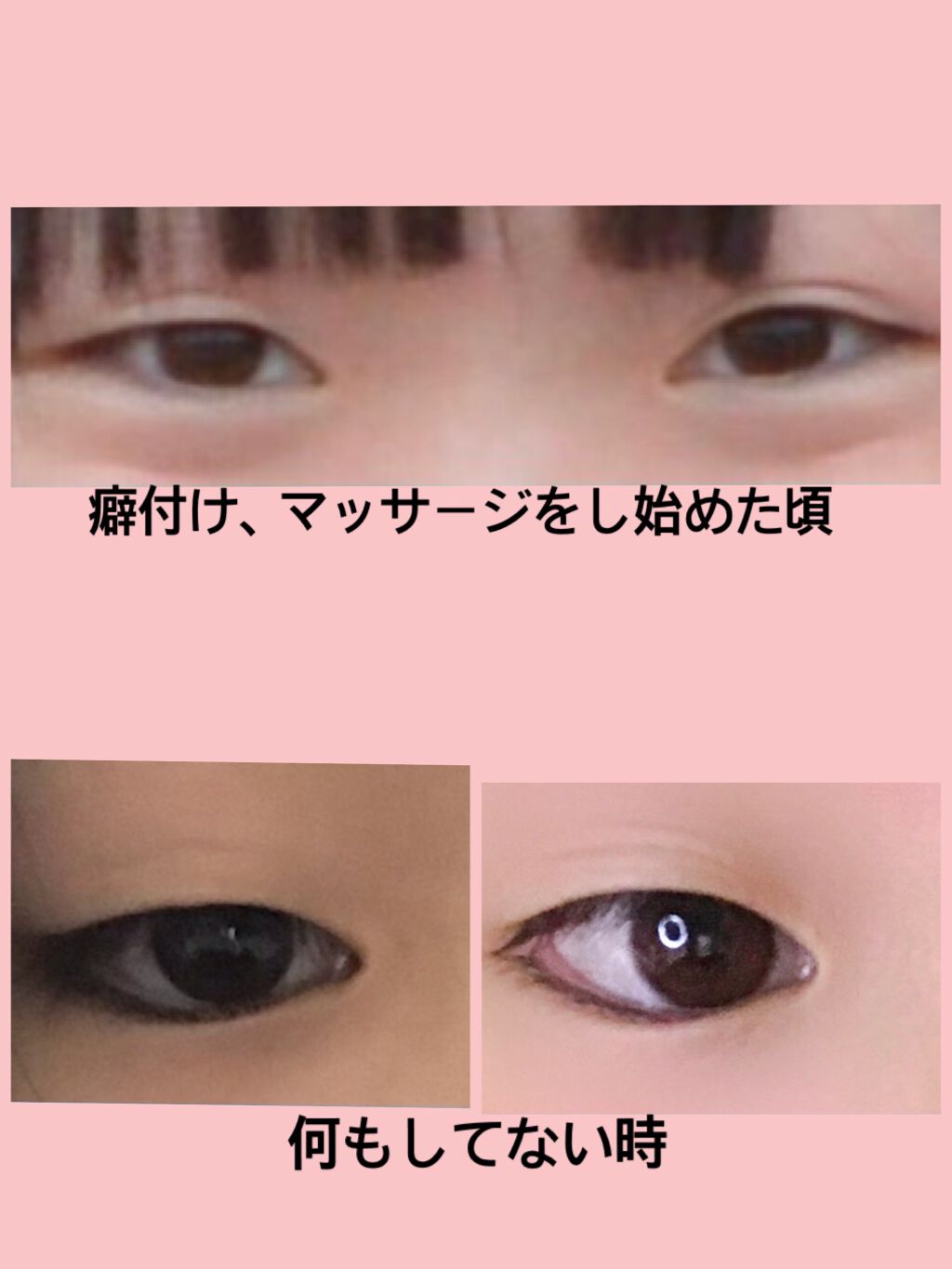 アイトーク/アイトーク/二重まぶた用アイテムを使ったクチコミ（2枚目）