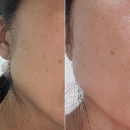 バリアサイクルトナーパッド/P.CALM/トナーパッドを使ったクチコミ(7枚目)