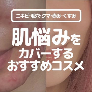 SHISEIDO スポッツカバー ファウンデイションのクチコミ「今回は、様々な肌悩みに合わせて
悩みをカバーして解決してくれる
優秀コスメについてまとめてみま.....」（1枚目）