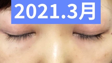 EMAKED(エマーキット)/水橋保寿堂製薬/まつげ美容液を使ったクチコミ(3枚目)