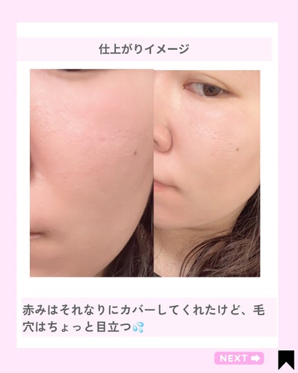 Kana on LIPS 「ドクダミクッション/@kana.cosme2525他の投稿はこ..」(5枚目)