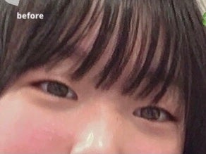 \\現役JC// on LIPS 「┈┈┈┈┈┈┈┈┈┈┈┈┈┈┈┈┈┈┈┈┈┈┈❕私が二重にした..」(2枚目)