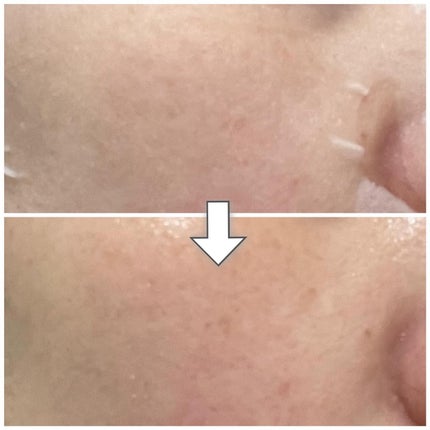 コラーゲン30daysマスク/One-day's you/シートマスク・パックを使ったクチコミ(7枚目)