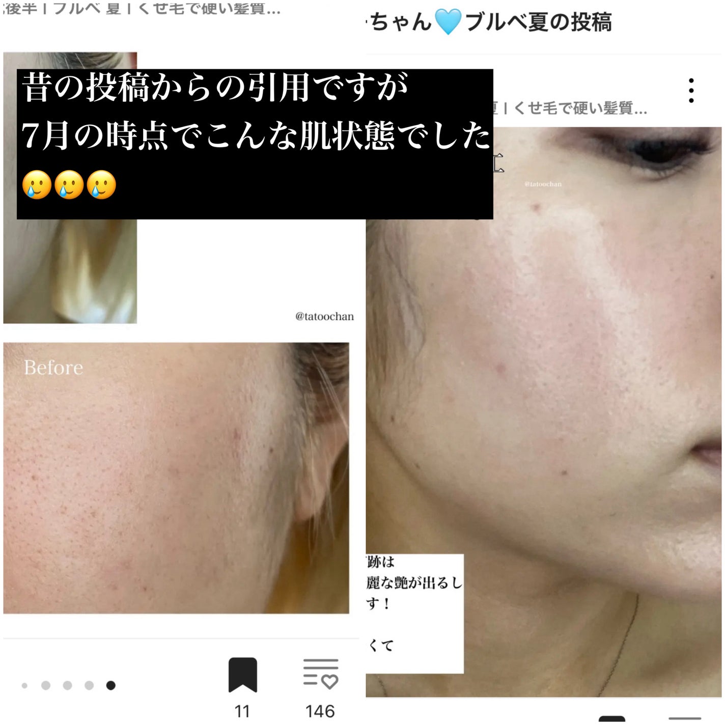 レッドブレミッシュ リペアスージングクリーム/Dr.G/フェイスクリームを使ったクチコミ(4枚目)