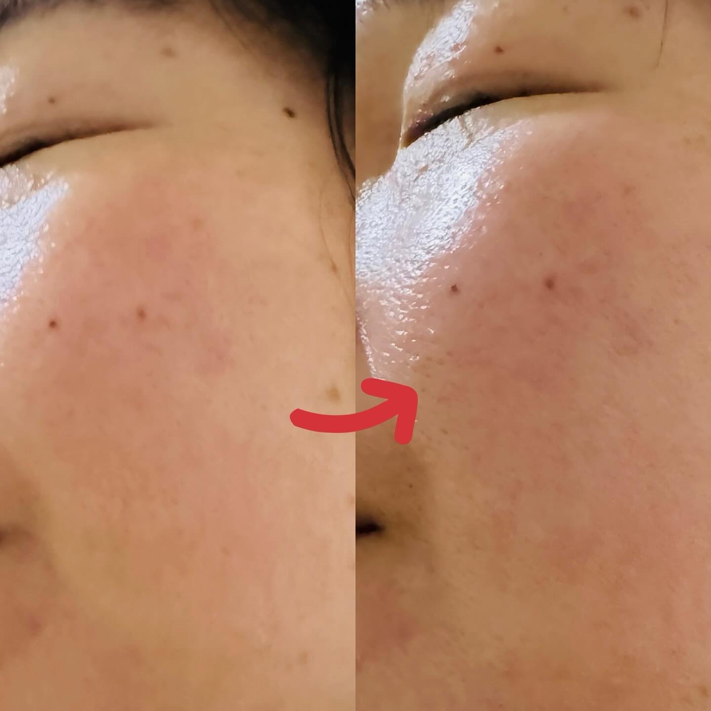 サンカットクリーム/アクアヴィーナス/日焼け止めクリームを使ったクチコミ（2枚目）