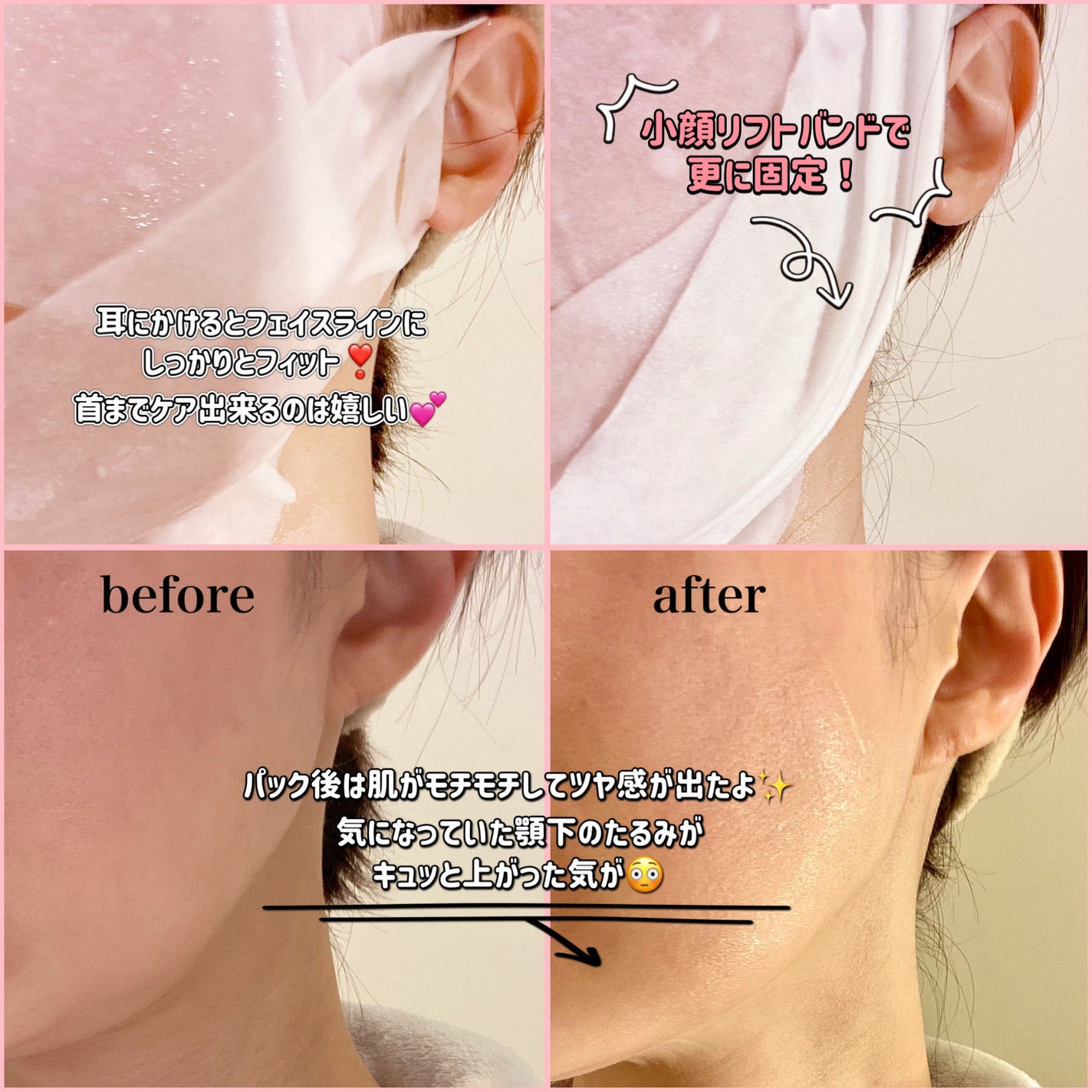 9番 NMNバイオリフトラッピングマスク/numbuzin/シートマスク・パックを使ったクチコミ(3枚目)