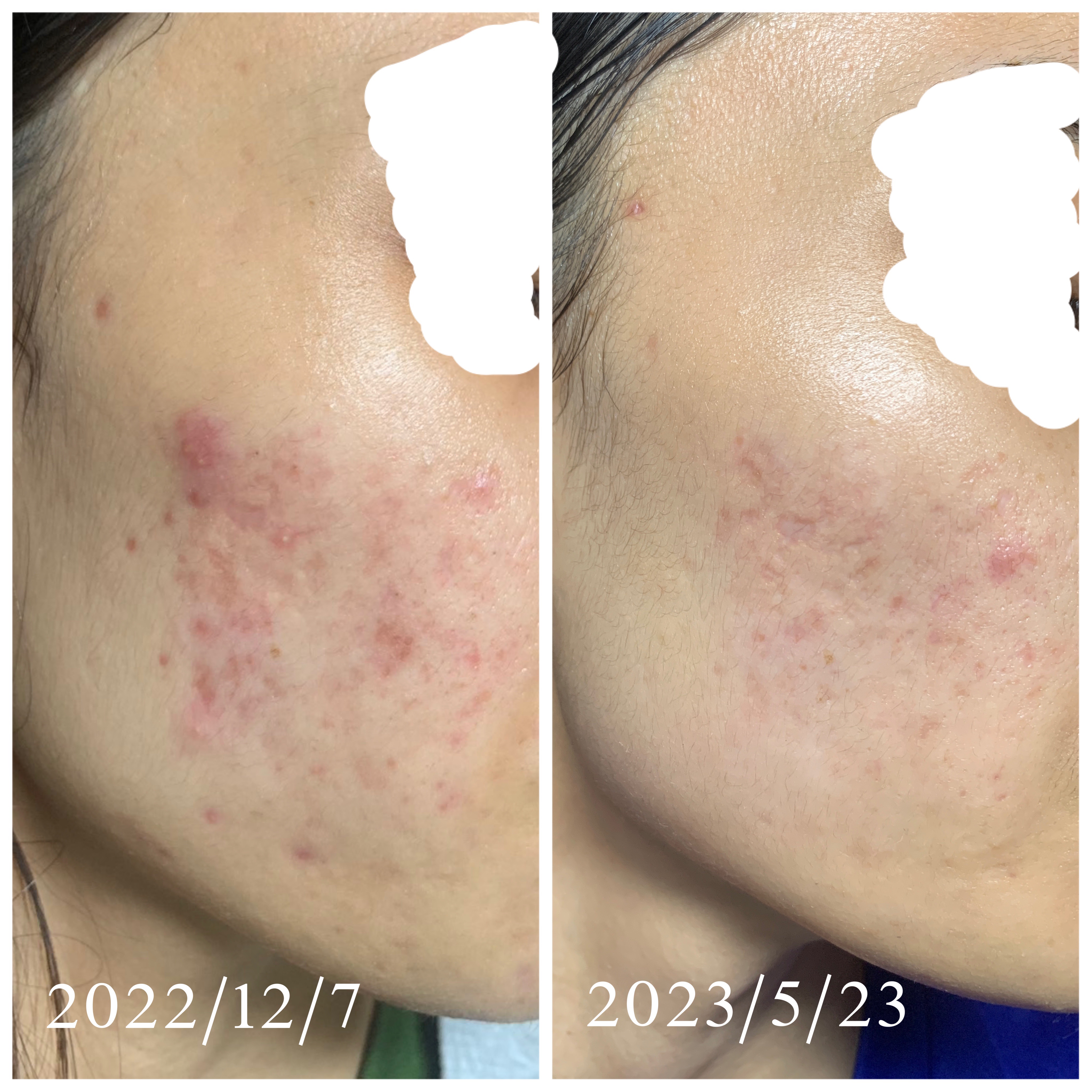 ウィプトソープ/シェルクルール/洗顔フォームを使ったクチコミ（1枚目）