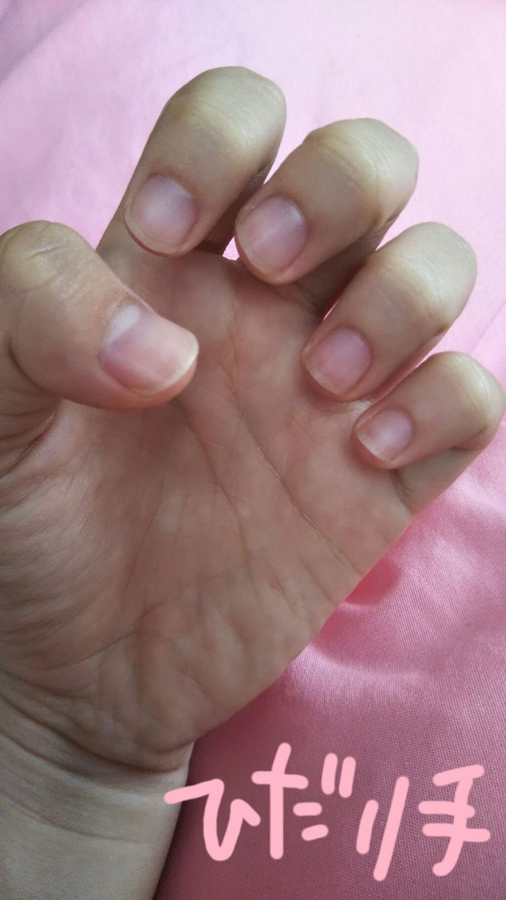 ウィンマックス キューティクルオイル/DAISO/ネイルオイル・トリートメントを使ったクチコミ（2枚目）