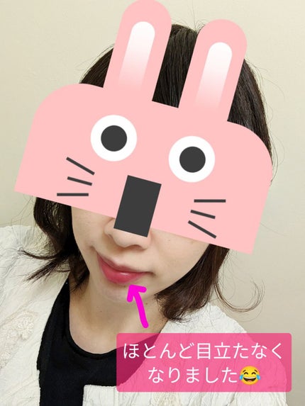 ディープモイスチャーナイトプロテクト はちみつの香り/ニベア/リップマスクを使ったクチコミ(3枚目)