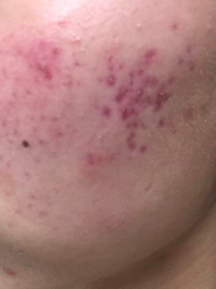 ããŒãœããã³ ããŒã·ã§ã³(å»è¬å)/æç°è£œè¬/ãã®ä»ã䜿ã£ãã¯ãã³ãïŒ1æç®ïŒ