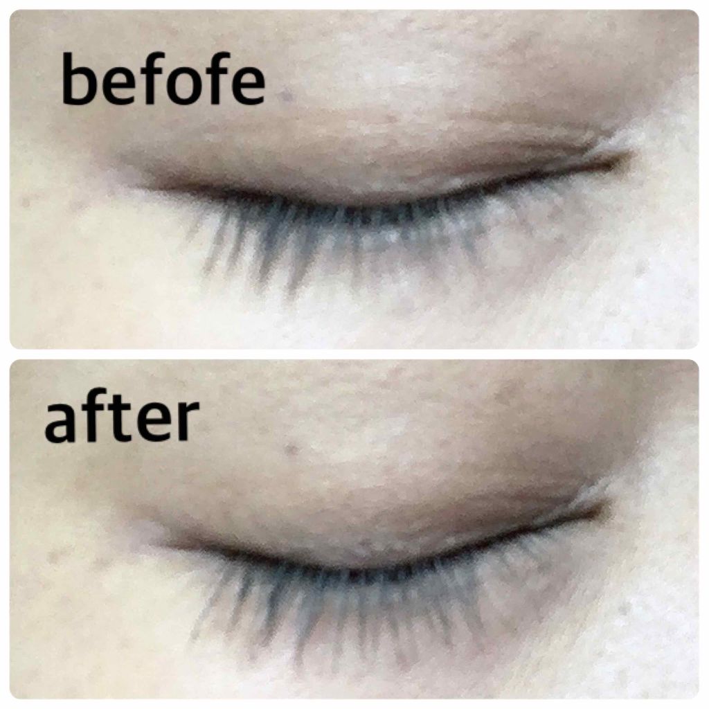 アイラッシュ セラム/ANNA SUI/まつげ美容液を使ったクチコミ(4枚目)