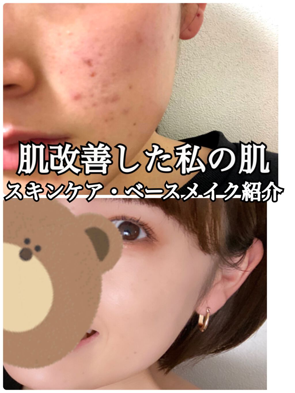 トリートメント クレンジング ミルク/COVERMARK/ミルククレンジングを使ったクチコミ（1枚目）