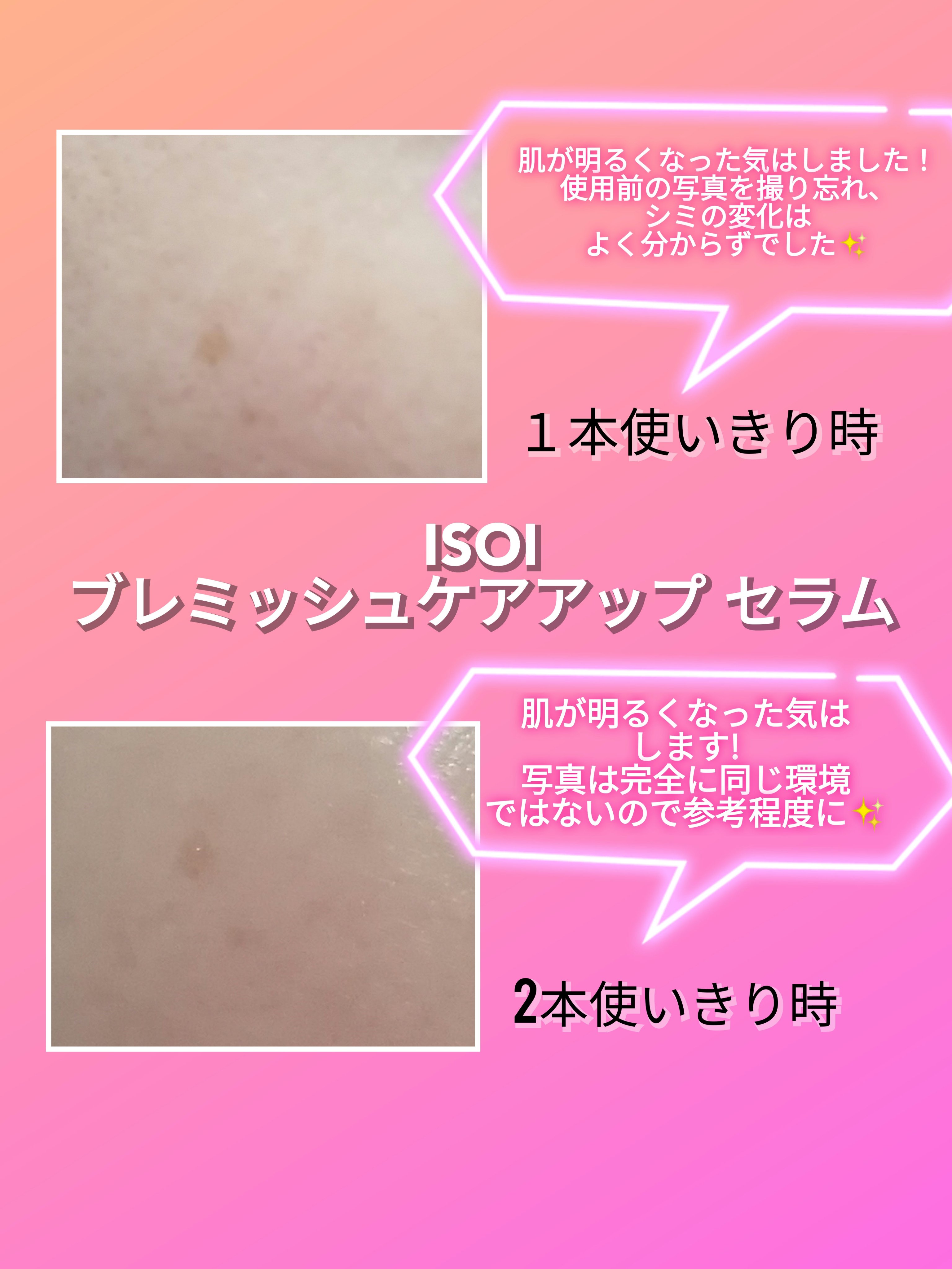 Qoo10/Qoo10/シートマスク・パックを使ったクチコミ（2枚目）