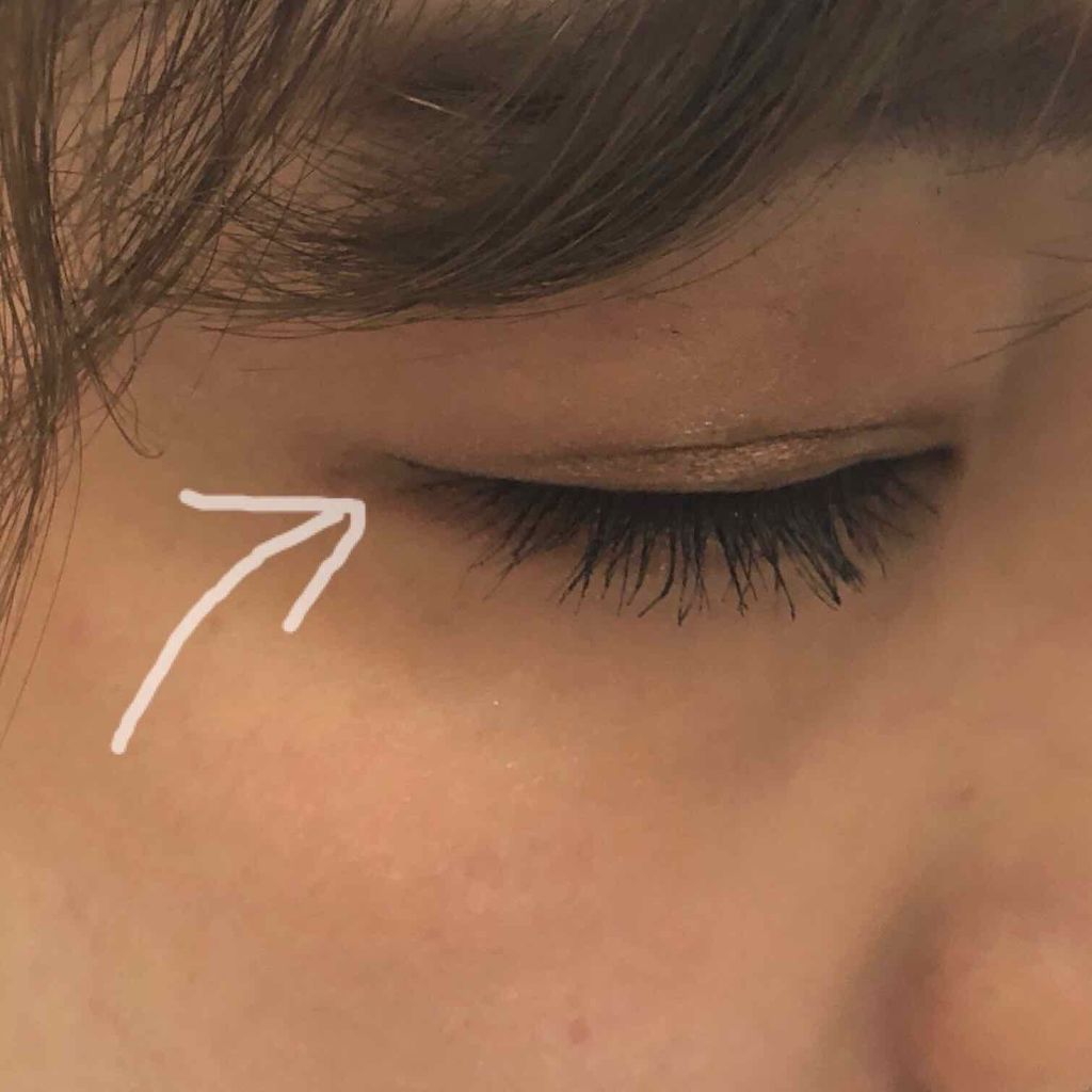 ハイブリッドフィルム/アイトーク/二重まぶた用アイテムを使ったクチコミ(2枚目)