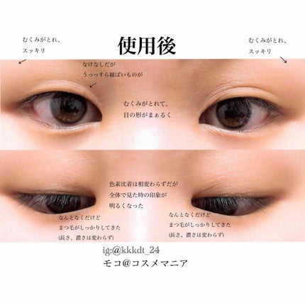 グラン アイ セラム/CLARINS/アイケア・アイクリームを使ったクチコミ(4枚目)