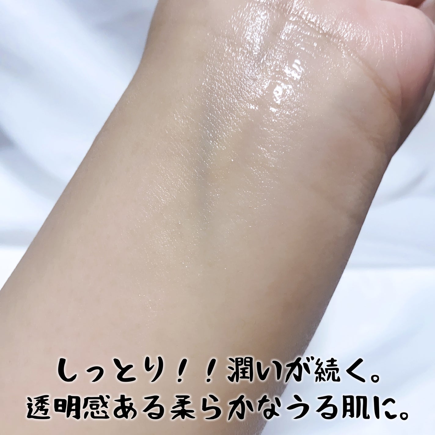 オイデルミン エッセンスローション/SHISEIDO/化粧水を使ったクチコミ(4枚目)