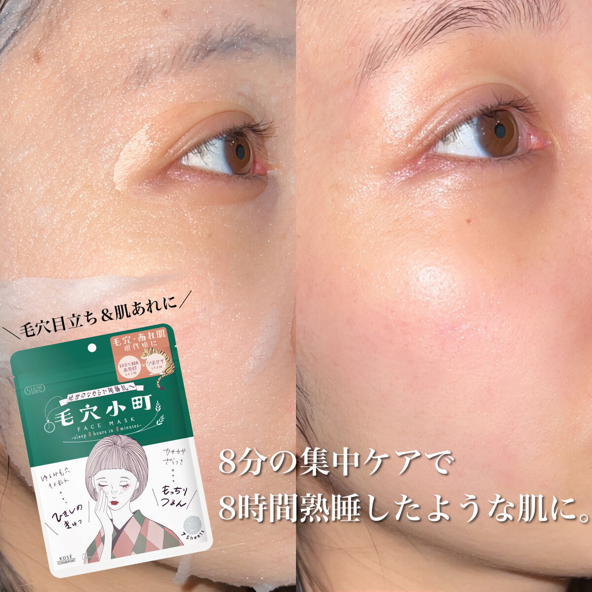 チャンユカ on LIPS 「〖 8分間でなめらか陶器肌へ💎 〗毛穴