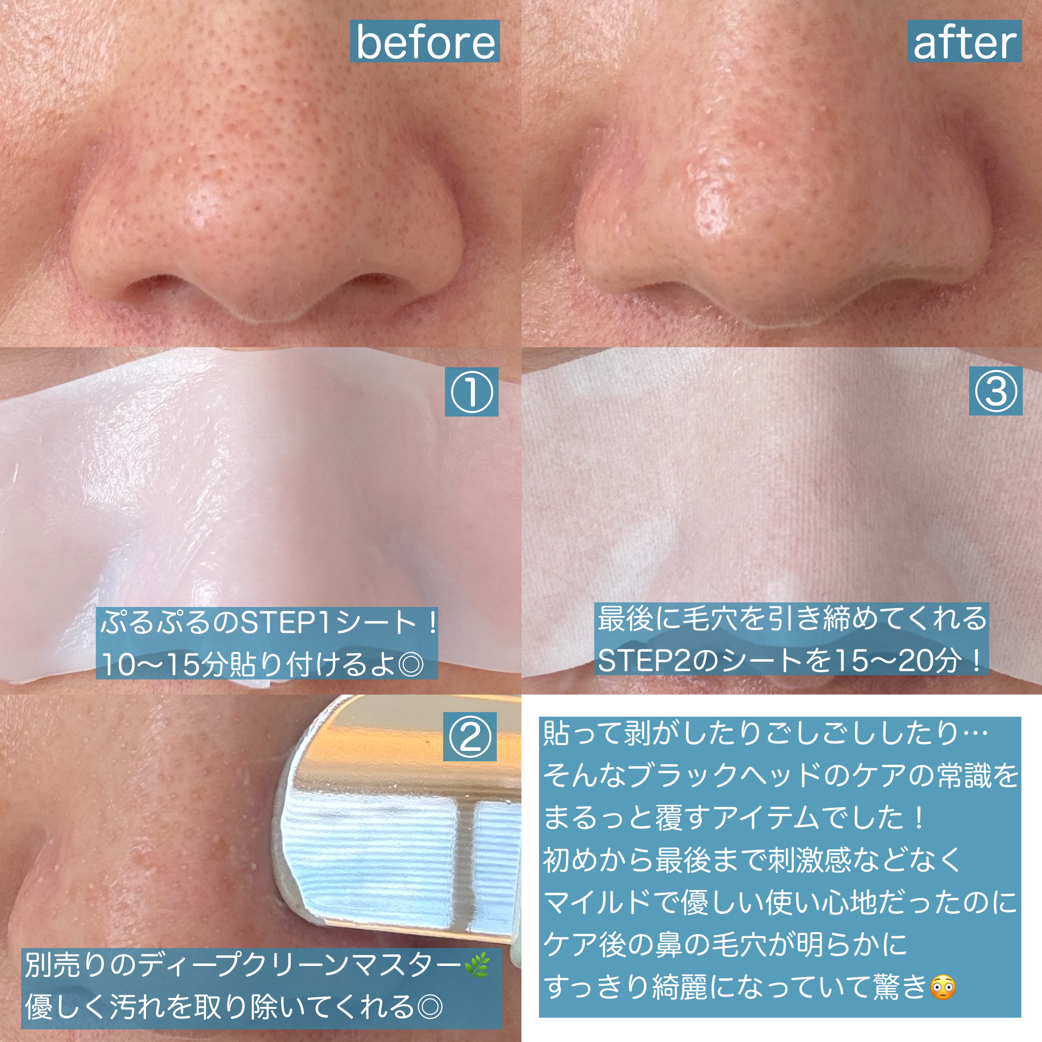 ディープクリーンマスター/ilso/その他スキンケアグッズを使ったクチコミ（2枚目）